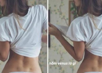 Hõm venus ở nữ là gì?