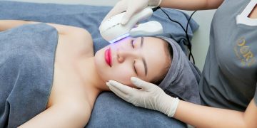 Spa trị mụn gò vấp